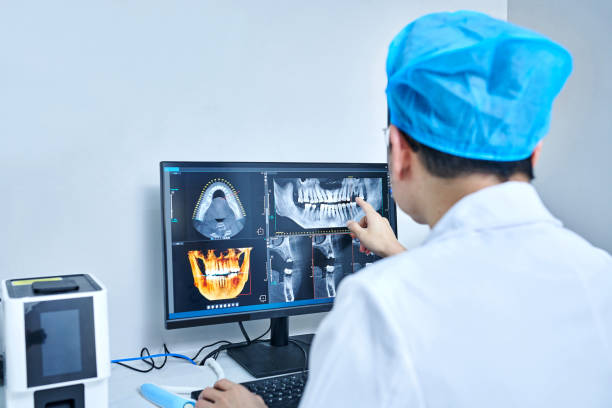 Best Emergency Dental Care for Broken or Chipped Teeth in San Carlos Park, FL