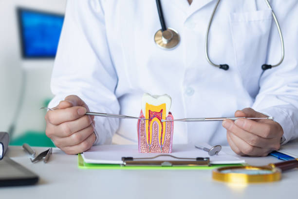 Best Emergency Root Canal Treatment in San Carlos Park, FL